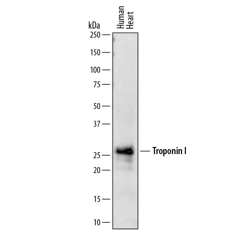 Detection of Human Troponin I antibody by Western Blot.