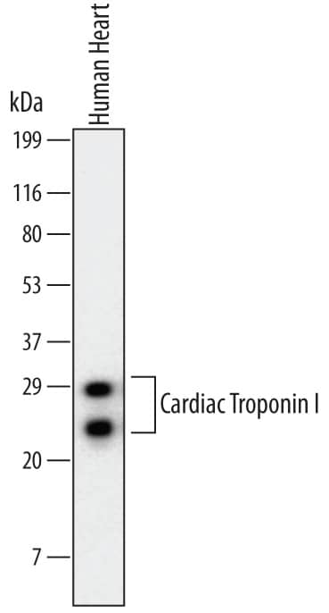 Detection of Human Cardiac Troponin I antibody by Western Blot.