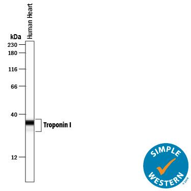Detection of Human Troponin I antibody by Simple WesternTM.