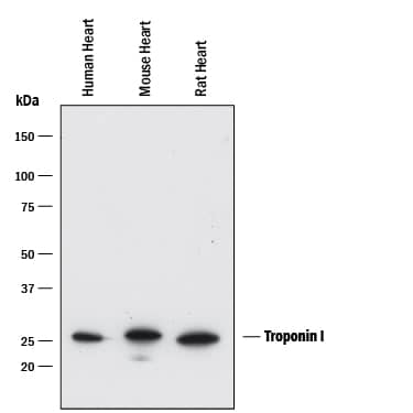 Detection of Human, Mouse, and Rat Troponin I antibody by Western Blot.