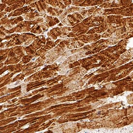 Troponin T antibody in Human Heart by Immunohistochemistry (IHC-P).