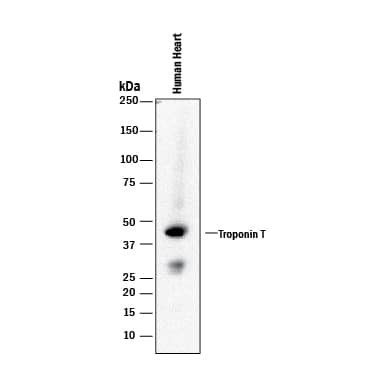 Detection of Human Troponin T antibody by Western Blot.