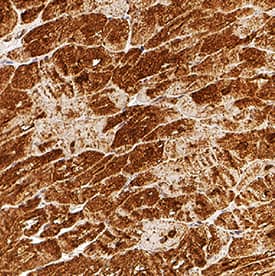 Troponin T antibody in Human Heart by Immunohistochemistry (IHC-P).