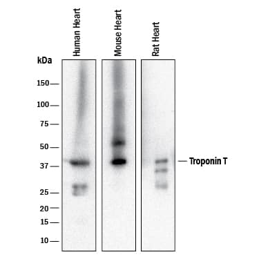 Detection of Human, Mouse, and Rat Troponin T antibody by Western Blot.