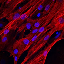 Troponin T antibody in BG01V Human Embryonic Stem Cells by Immunocytochemistry (ICC).