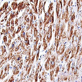 Troponin T in Human Heart. Troponin T antibody in Human Heart by Immunohistochemistry (IHC-P).
