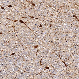 Tryptophan Hydroxylase 1/TPH-1 antibody in Human Brain by Immunohistochemistry (IHC-P).