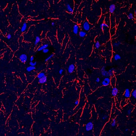 Tryptophan Hydroxylase 1/TPH-1 antibody in Rat Brain by Immunohistochemistry (IHC-Fr).