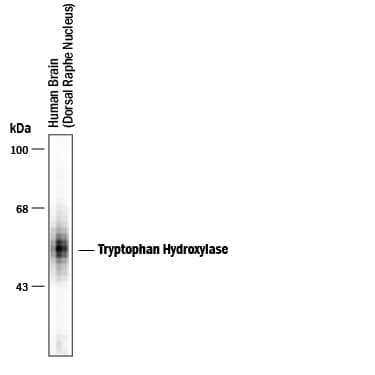 Detection of Tryptophan Hydroxylase antibody by Western Blot.