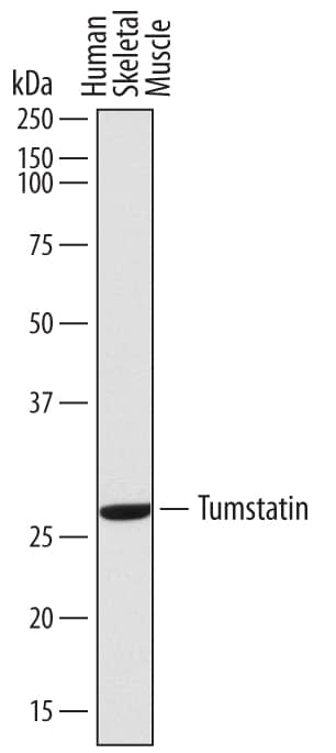 Detection of Human Tumstatin antibody by Western Blot.