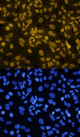 Twist-1 antibody in A549 Human Cell Line by Immunocytochemistry (ICC).