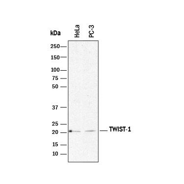 Detection of Human Twist-1 antibody by Western Blot.