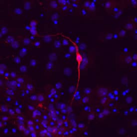 Tyrosine Hydroxylase in D3 Mouse Embryonic Stem Cells. Tyrosine Hydroxylase antibody in D3 Mouse Embryonic Stem Cells by Immunocytochemistry (ICC).