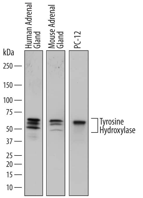 Detection of Human, Mouse, and Rat Tyrosine Hydroxylase antibody by Western Blot.