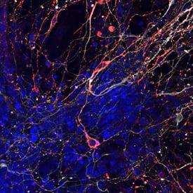 Tyrosine Hydroxylase antibody in Mouse Dopaminergic Neurons by Immunocytochemistry (ICC).
