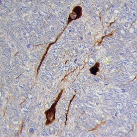 Tyrosine Hydroxylase antibody in Human Brain by Immunohistochemistry (IHC-P).