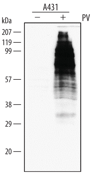 Detection of Phospho-Tyrosine antibody by Western Blot.