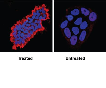Phospho-Tyrosine antibody in A431 Human Cell Line by Immunocytochemistry (ICC).