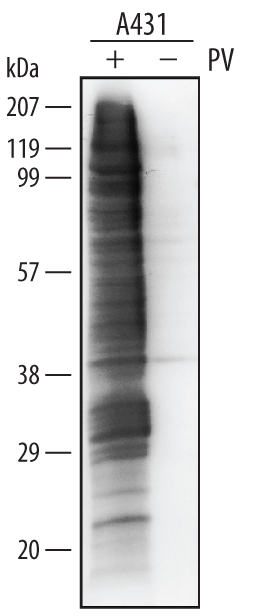 Detection of Phospho-Tyrosine antibody by Western Blot.