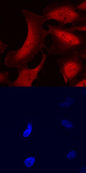UBASH3B/STS1 antibody in HeLa Human Cell Line by Immunocytochemistry (ICC).