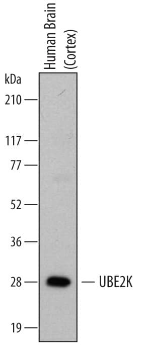 Detection of Human UBE2K/E2-25K antibody by Western Blot.