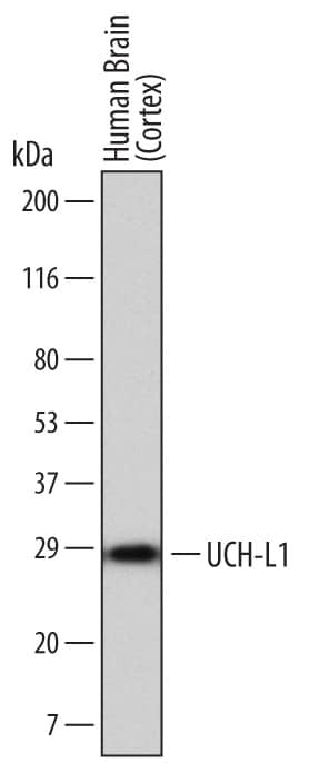 Detection of Human UCH-L1/PGP9.5 antibody by Western Blot.