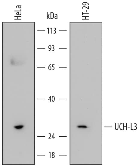 Detection of Human UCH-L3 antibody by Western Blot.