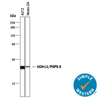 Detection of Human and Mouse UCH-L1 antibody by Simple WesternTM.
