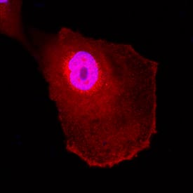 UCH-L1/PGP9 by Immunocytochemistry (ICC).5 antibody in A172 Human Cell Line by Immunocytochemistry (ICC).