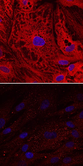 UCP1 antibody in Human Mesenchymal Stem Cells by Immunocytochemistry (ICC).