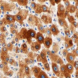 Glucuronosyltransferase 1A1/UGT1A1 antibody in Human Liver by Immunohistochemistry (IHC-P).