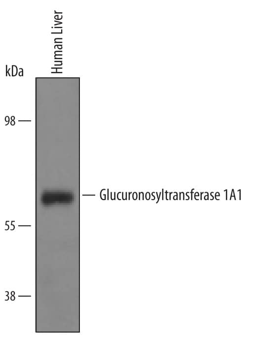 Detection of Human Glucuronosyltransferase 1A1/UGT1A1 antibody by Western Blot.