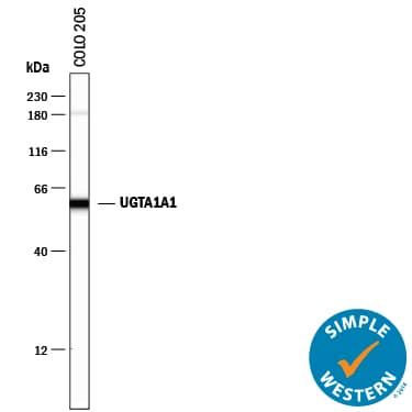 Detection of Human Glucuronosyltransferase 1A1/UGT1A1 antibody by Simple WesternTM.