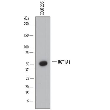 Detection of Human Glucuronosyltransferase 1A1/UGT1A1 antibody by Western Blot.