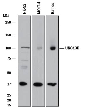 Detection of Human UNC13D antibody by Western Blot.