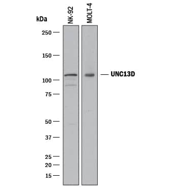 Detection of Human UNC13D antibody by Western Blot.