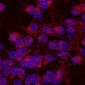 UNC5H1 antibody in Rat Cortical Stem Cells by Immunocytochemistry (ICC).