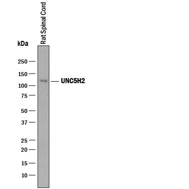 Detection of Rat UNC5H2 antibody by Western Blot.