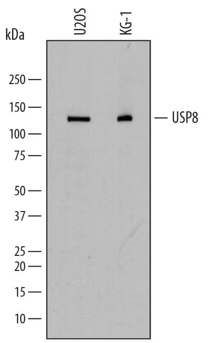 Detection of Human USP8 antibody by Western Blot.