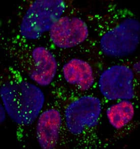 UTF1 antibody in BG01V Human Embryonic Stem Cells by Immunocytochemistry (ICC).