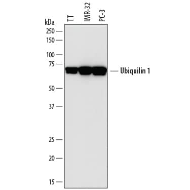 Detection of Human Ubiquilin 1 antibody by Western Blot.