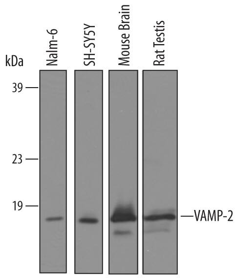 Detection of Human, Mouse, and Rat VAMP-2 antibody by Western Blot.