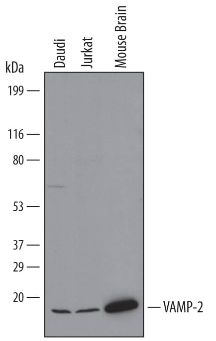 Detection of Human and Mouse VAMP-2 antibody by Western Blot.