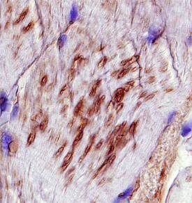 VAMP-5 antibody in Human Skeletal Muscle by Immunohistochemistry (IHC-P).