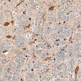 VAP-A antibody in Human Brain by Immunohistochemistry (IHC-P).
