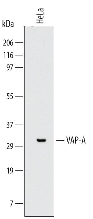 Detection of Human VAP-A antibody by Western Blot.