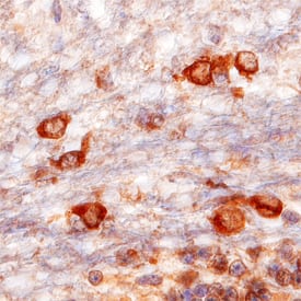 VAP-B antibody in Human Brain by Immunohistochemistry (IHC-P).