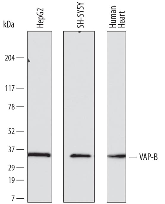 Detection of Human VAP-B antibody by Western Blot.