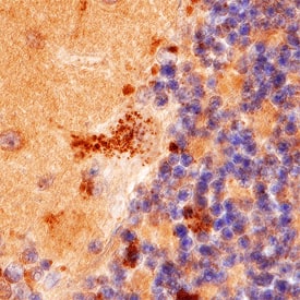 VAP-B antibody in Human Brain by Immunohistochemistry (IHC-P).