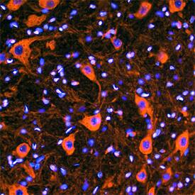 VAP-B antibody in Rat Brain by Immunohistochemistry (IHC-Fr).